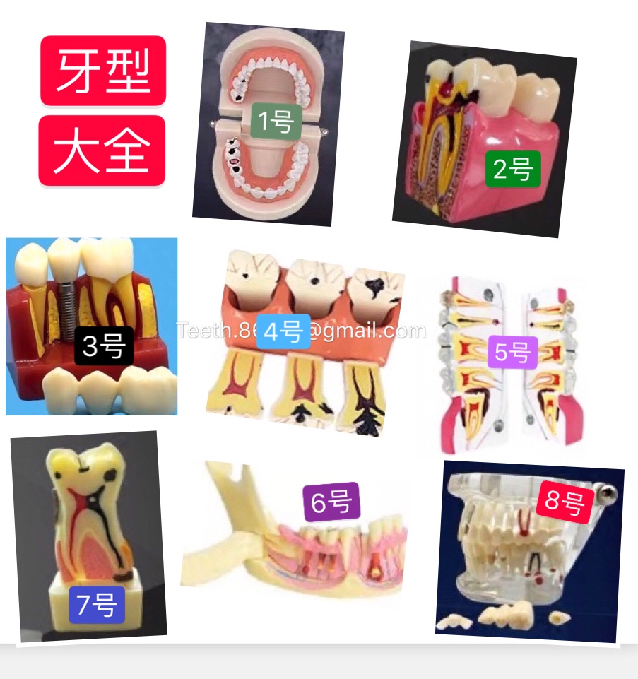 牙科模型口腔病理医患沟通演示模型种植成人嵌体瓷贴面连桥模型在类目 个人护理/保健/按摩器材, 口腔护理, 其它口腔治疗设备中 - 来自Buy2taobao.com提供专业的淘宝代购服务